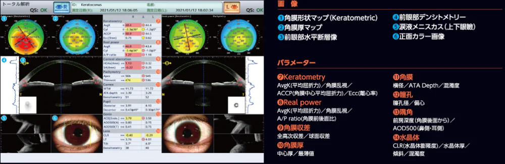 CASIA2検査画面